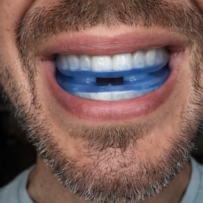 RivantaX™ – Bite anti-russamento discreto e facile da usare