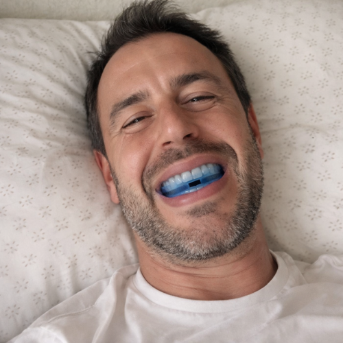 RivantaX™ – Bite anti-russamento discreto e facile da usare